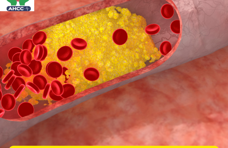 What are 10 warning signs of high cholesterol