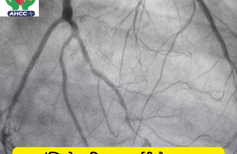 क्या एंजियोग्राफी एक सर्जरी है या यह एक सामान्य प्रक्रिया है