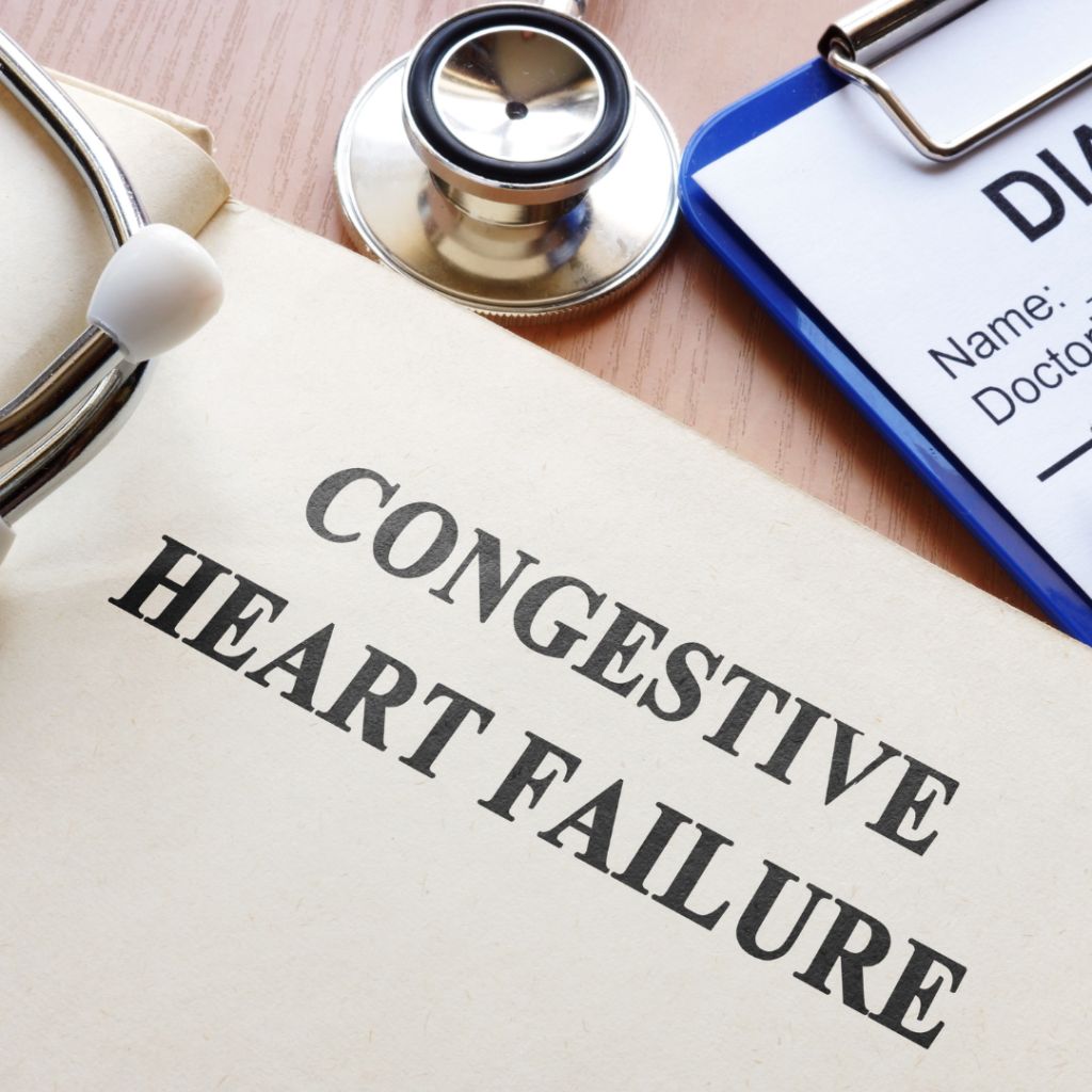 Managing congestive heart failure
